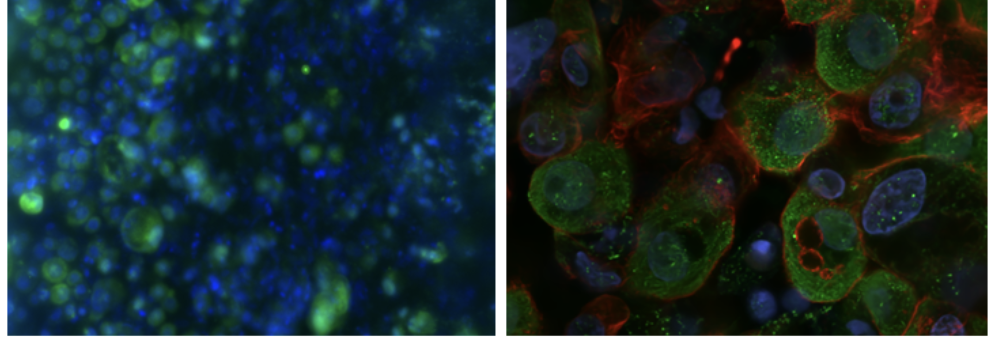 Side-by-side fluorescence microscopy images of cells. The left panel shows cells stained in blue and green at lower magnification, revealing densely packed nuclei with scattered green puncta. The right panel shows a higher-magnification view of larger cells with green cytoplasmic staining, blue nuclei, red membrane or cytoskeletal staining, and small bright green dots indicating specific protein localization.
